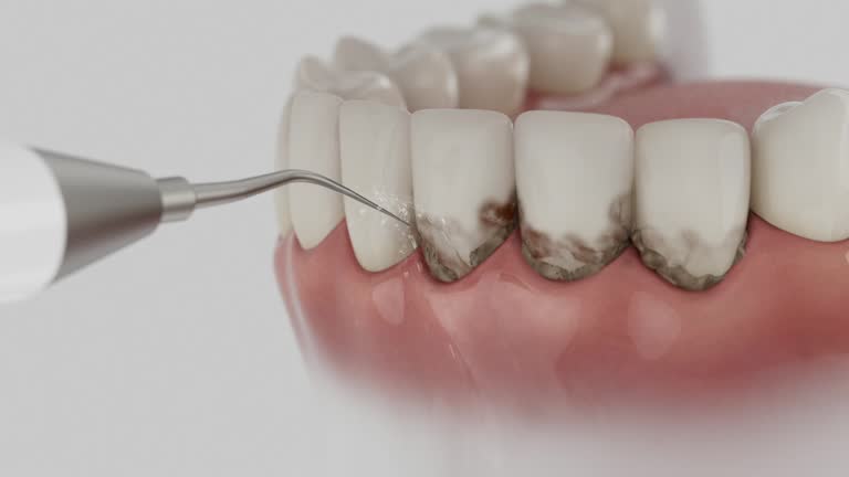 Reliable Wisdom Tooth Removal contractor in Richland County County, OH by Dentist Open Now